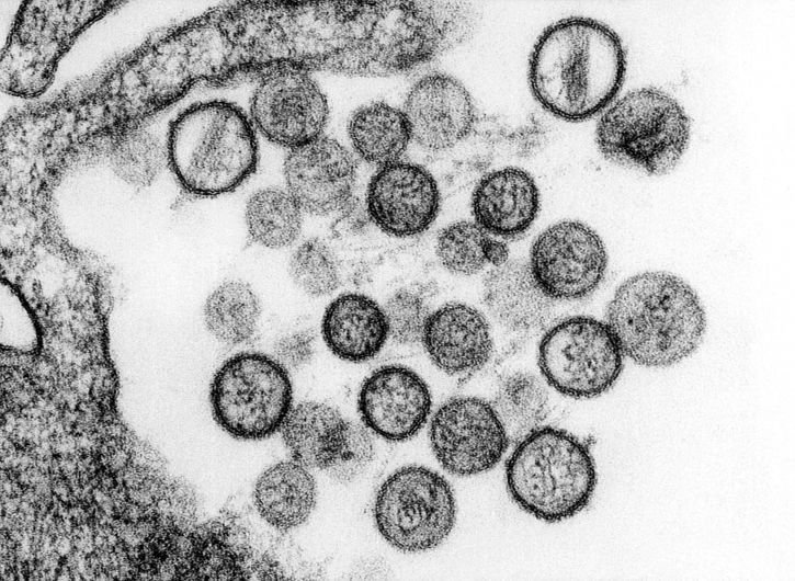 virus-particles-or-virions-of-a-hantavirus-known-as-the-sin-nombre-virus-725x530