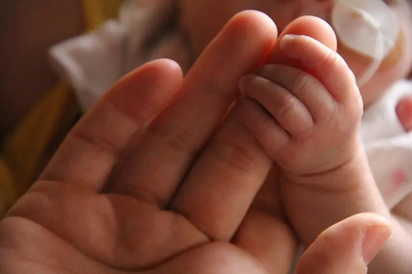 Cardiopatia congenita #4medios ni&ntilde;os bebes