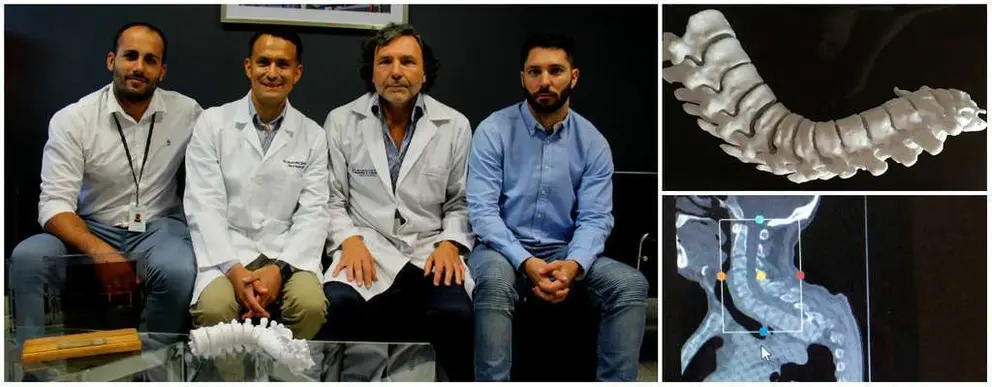 Columna 3D hospital el cruce unaj cuatro medios