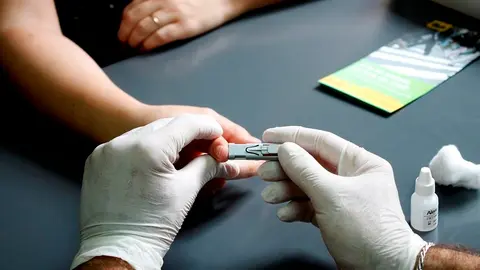 TEST-HIV