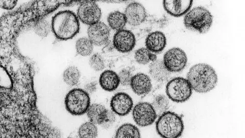virus-particles-or-virions-of-a-hantavirus-known-as-the-sin-nombre-virus-725x530