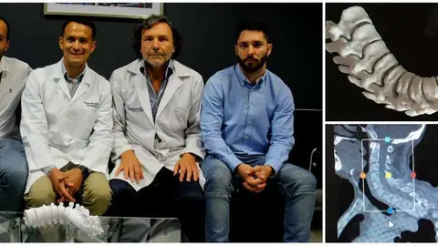 Columna 3D hospital el cruce unaj cuatro medios