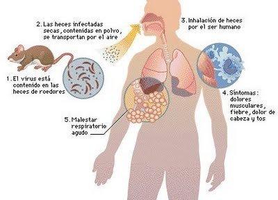 hantavirus1