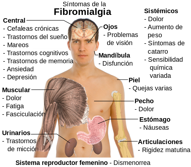 fibromialgia-todo-lo-que-sabemos-hasta-ahora-01